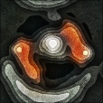 Variation 4