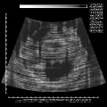 UltraSound v1.1