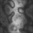 Bump Map