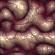 Variation 3
