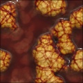Autopsy