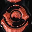 Variation 2