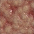 Veiny flesh