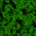 parasite