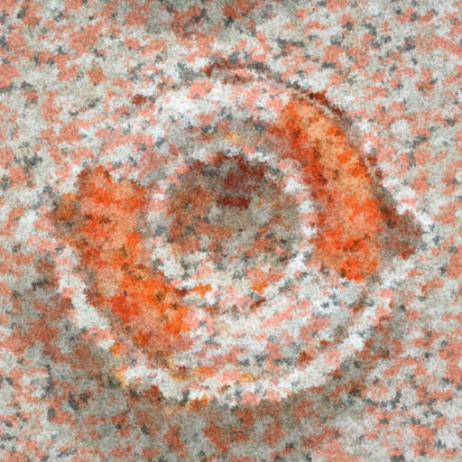Variation 5