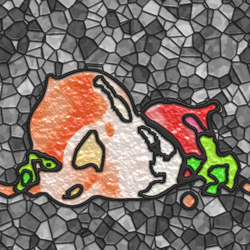 Variation 1