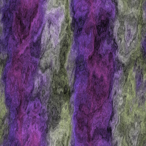 Variation 5