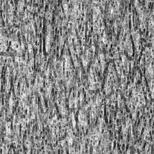 Ambient Occlusion Map