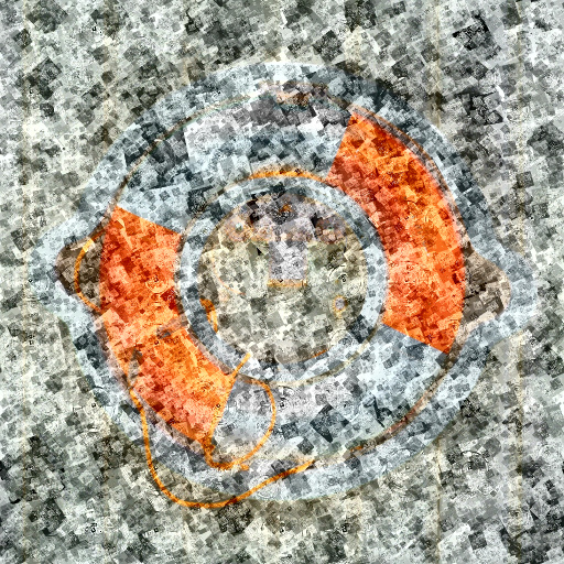 Variation 2