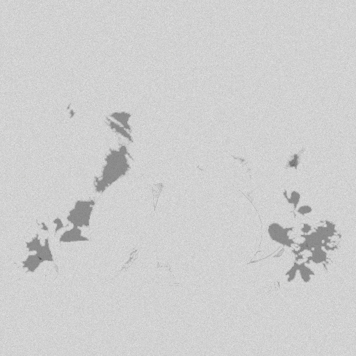 Bump Map