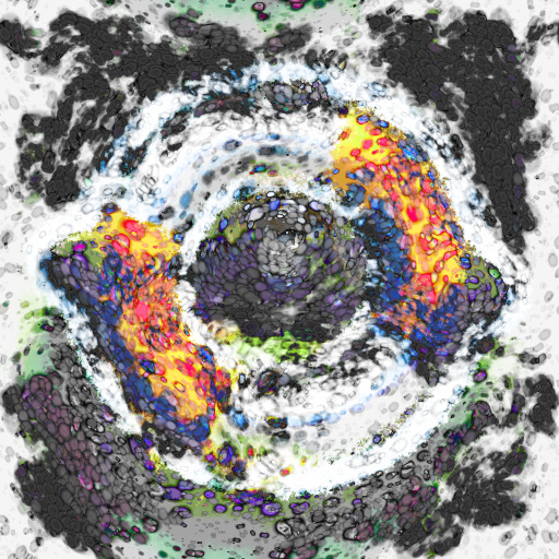 Variation 3