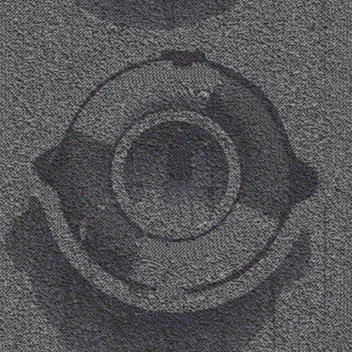 Variation 2
