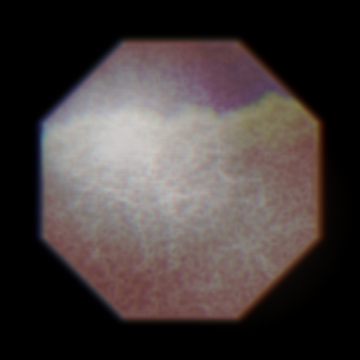 Variation 5