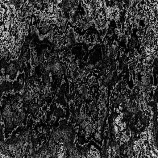 Tree Bark Image (Effect) - Ambient Occlusion Map