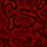 Coagulated Blood Bath