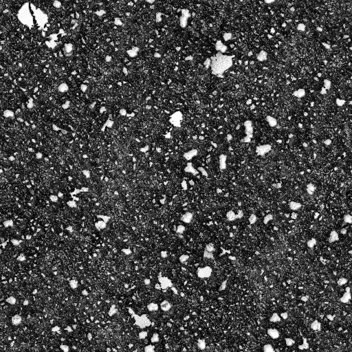 Ambient Occlusion Map