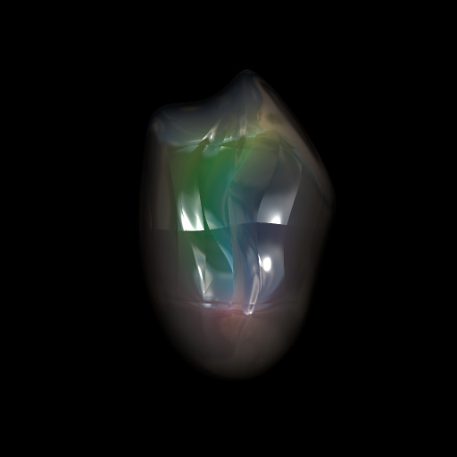 Variation 3
