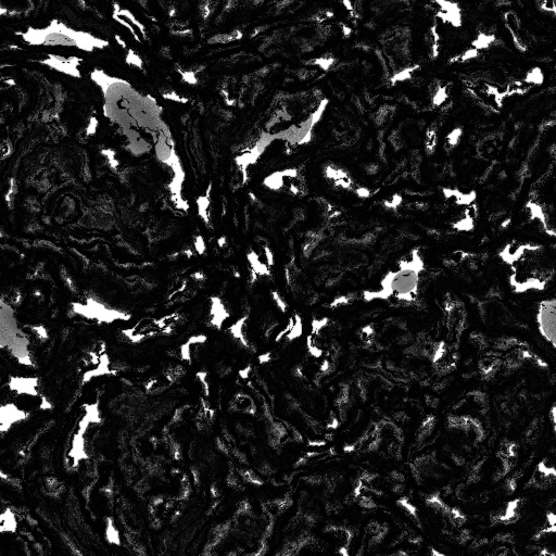 Ambient Occlusion Map