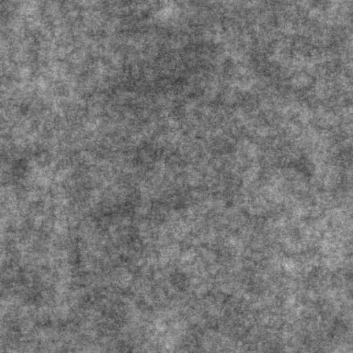 Bump Map