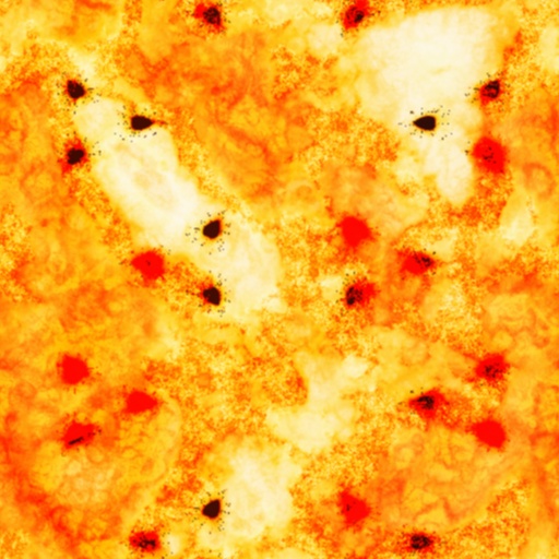 Variation 3