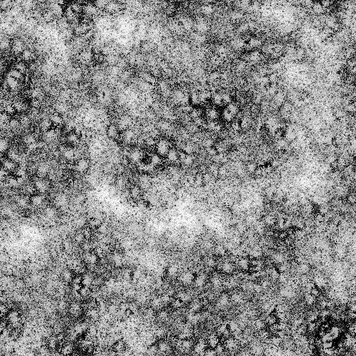 Ambient Occlusion Map