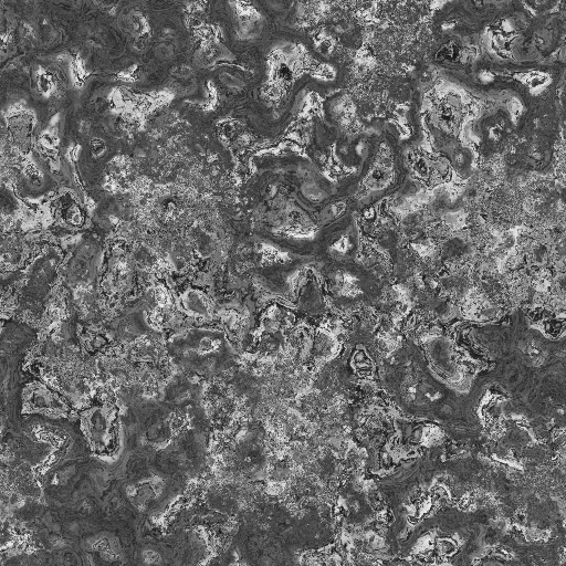 Bump Map