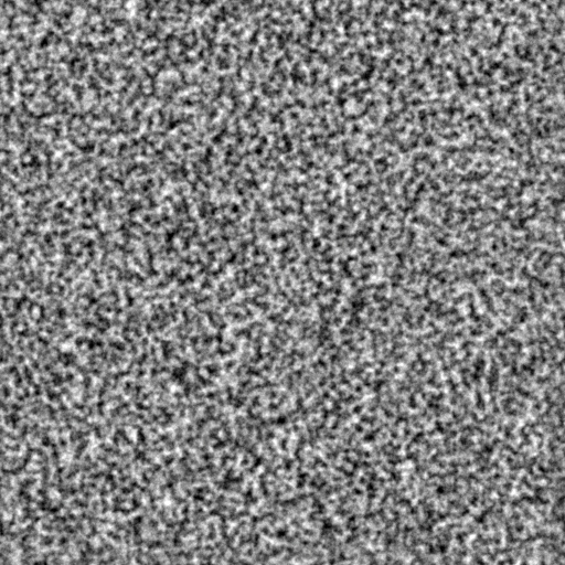 Bump Map