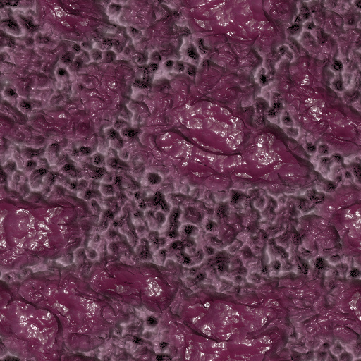Variation 3