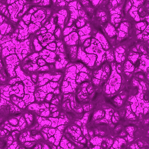 Variation 7