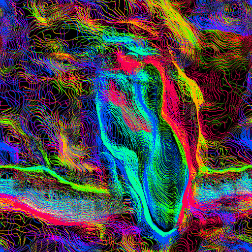 Variation 3