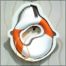 Luminance Bloat