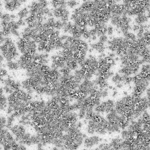 Ambient Occlusion Map
