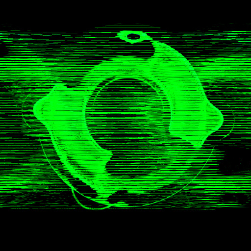 Variation 2