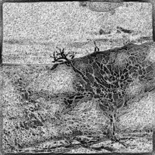 Ambient Occlusion Map