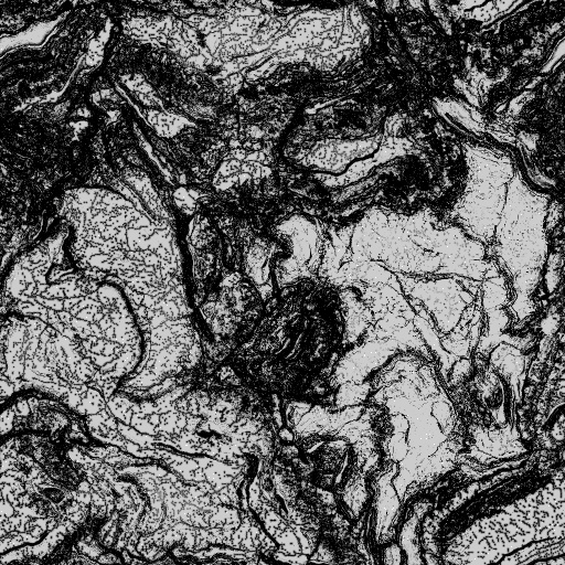 Landform Plus Surfaces (Texture)