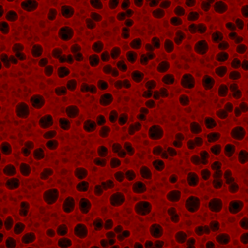Variation 1
