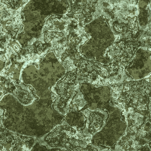 Variation 6