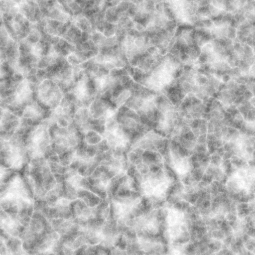 Bump Map