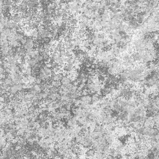 Bump Map