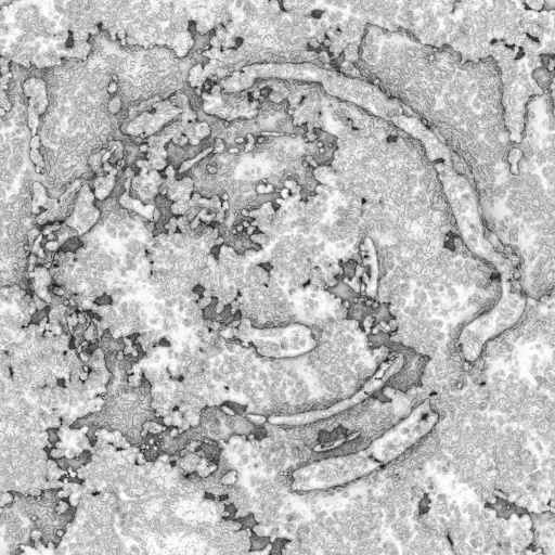 Ambient Occlusion Map