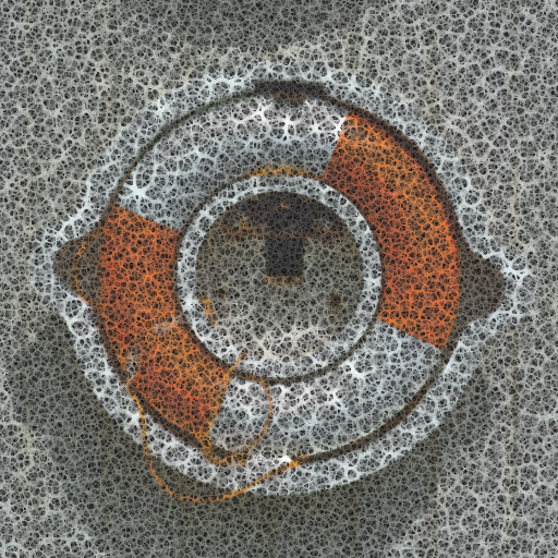 Variation 4