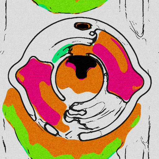 Variation 1