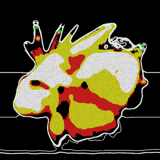 Variation 4