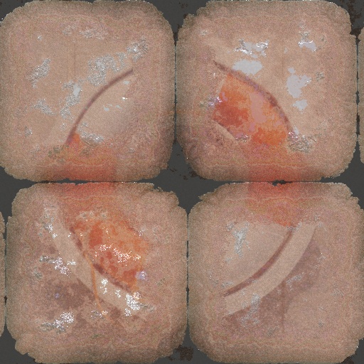 Variation 6