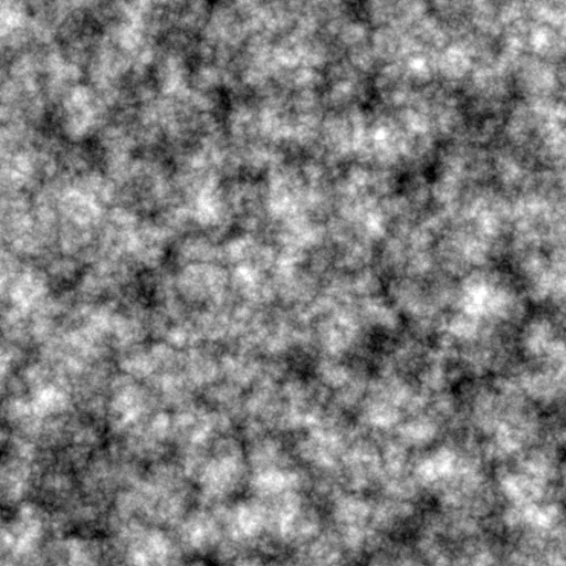 Bump Map