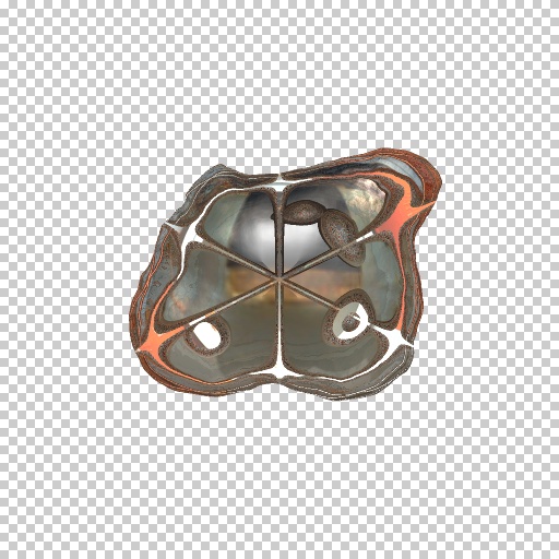 Variation 1