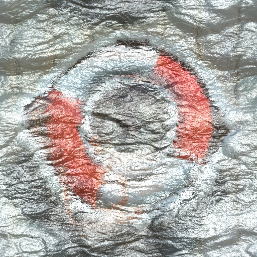 Variation 5