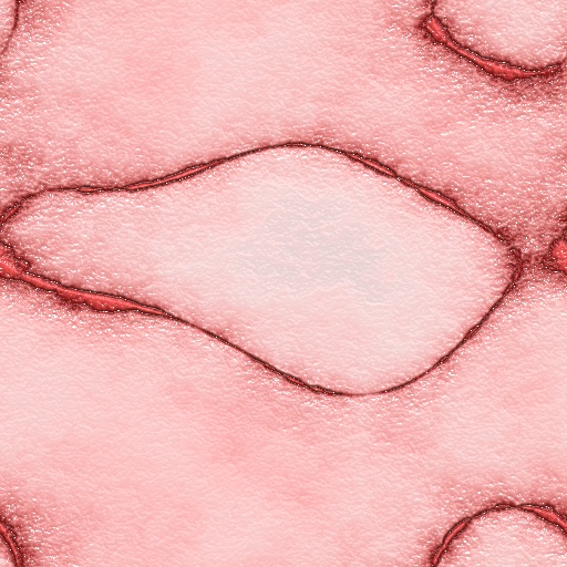 Variation 5