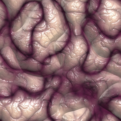 Variation 8