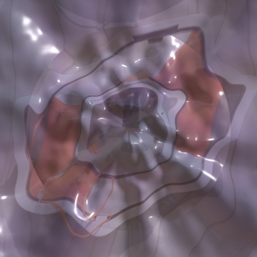 Variation 3